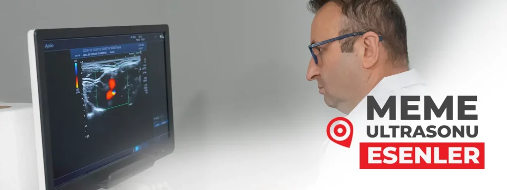 meme-ultrasonu-esenler-