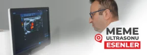 meme-ultrasonu-esenler-