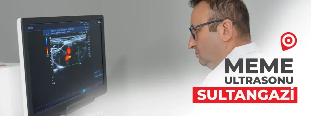 meme-ultrasonu-sultangazi